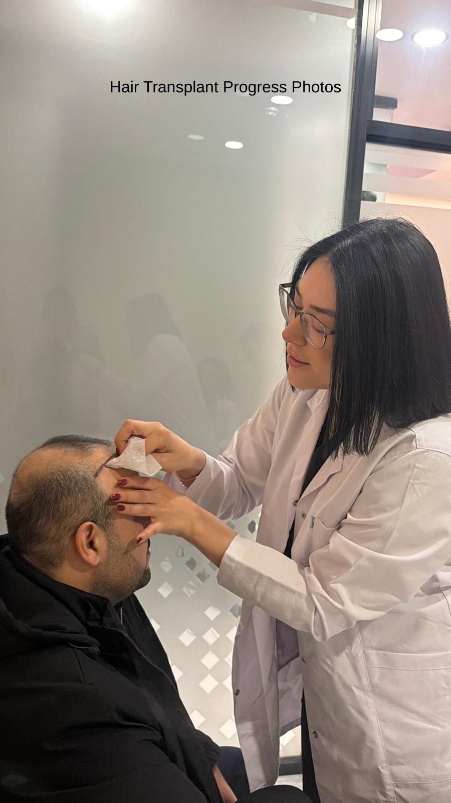 Hair Transplant Progress Photos