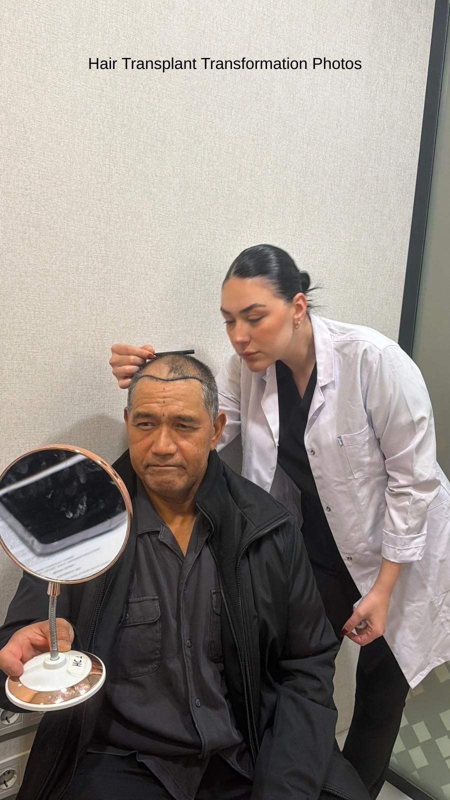 Hair Transplant Transformation Photos