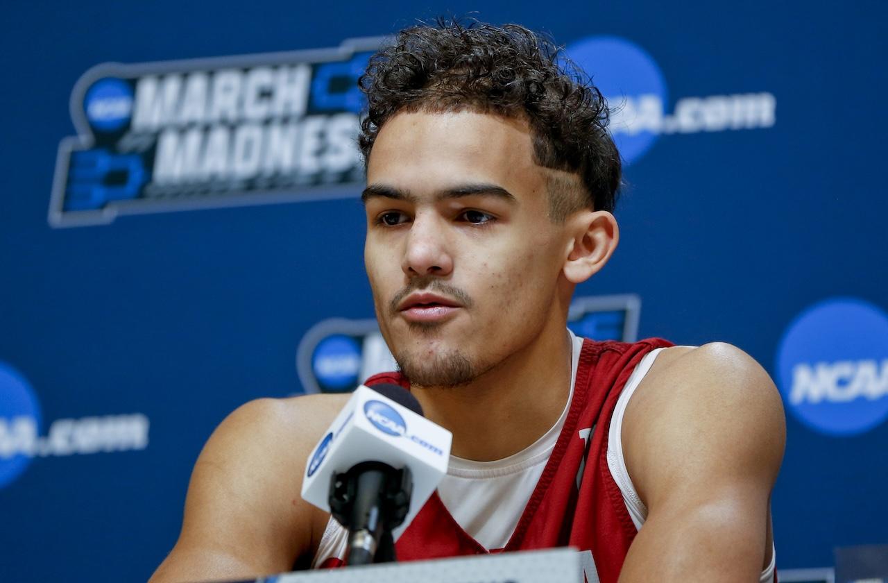 Trae Young Hair Transplant
