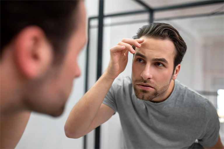 What Exactly Is No Shave Hair Transplant?
