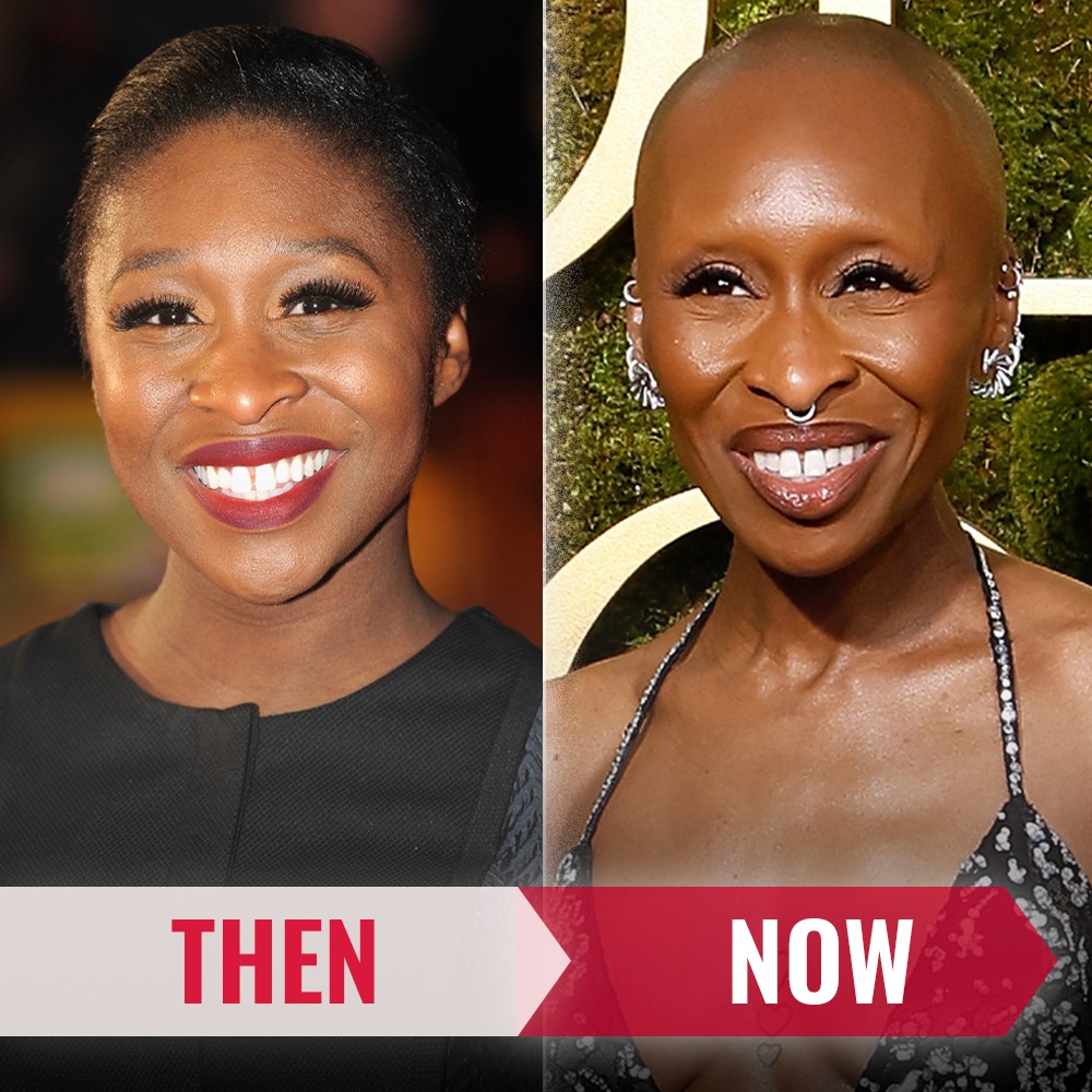 Cynthia Erivo's hairstyles from natural curls to shaved head.(Before and After)