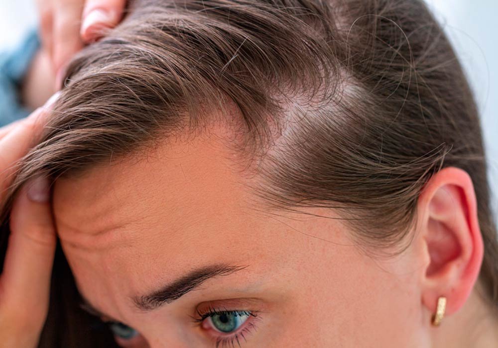 Foliculitis en el cuero cabelludo: síntomas, causas y tratamientos efectivos